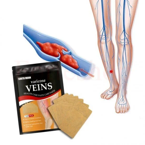 Пластири за разширени вени