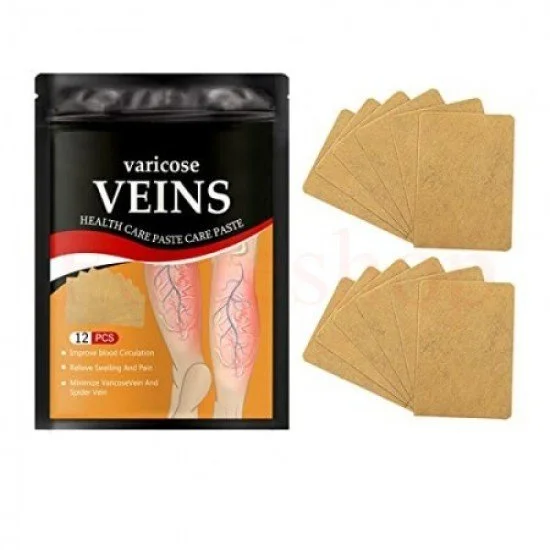 Пластири за разширени вени