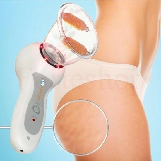 Антицелулитен уред