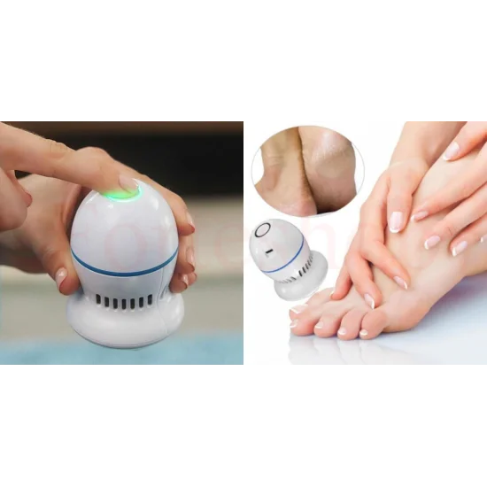 УРЕД ЗА ПРЕМАХВАНЕ НА ЗАГРУБЯЛАТА КОЖА С ВГРАДЕН ВАКУУМ