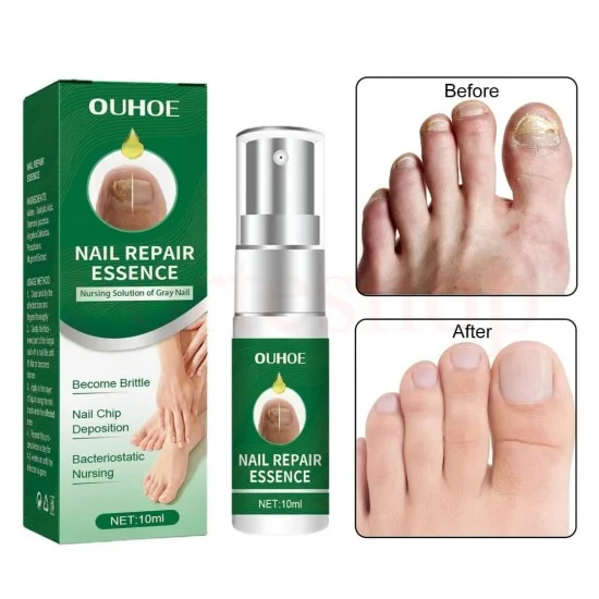 Подхранващ спрей есенция за нокти