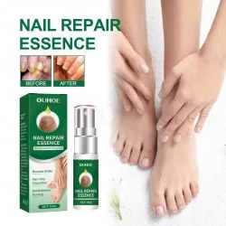Подхранващ спрей есенция за нокти