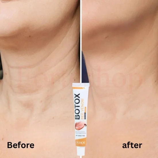 крем с пчелна отрова против бръчки bee venom botox