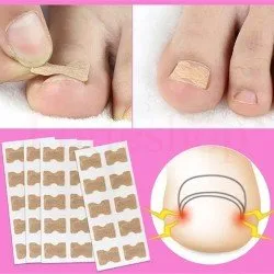 ЛЕПЕНКИ ЗА ВРАСТНАЛ НОКЪТ