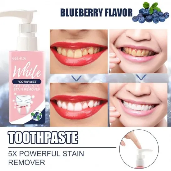 ИЗБЕЛВАЩА ПАСТА ЗА ЗЪБИ