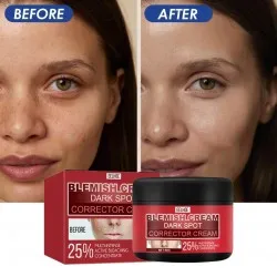 КРЕМ ЗА ПРЕМАХВАНЕ НА ПИГМЕНТАЦИЯ